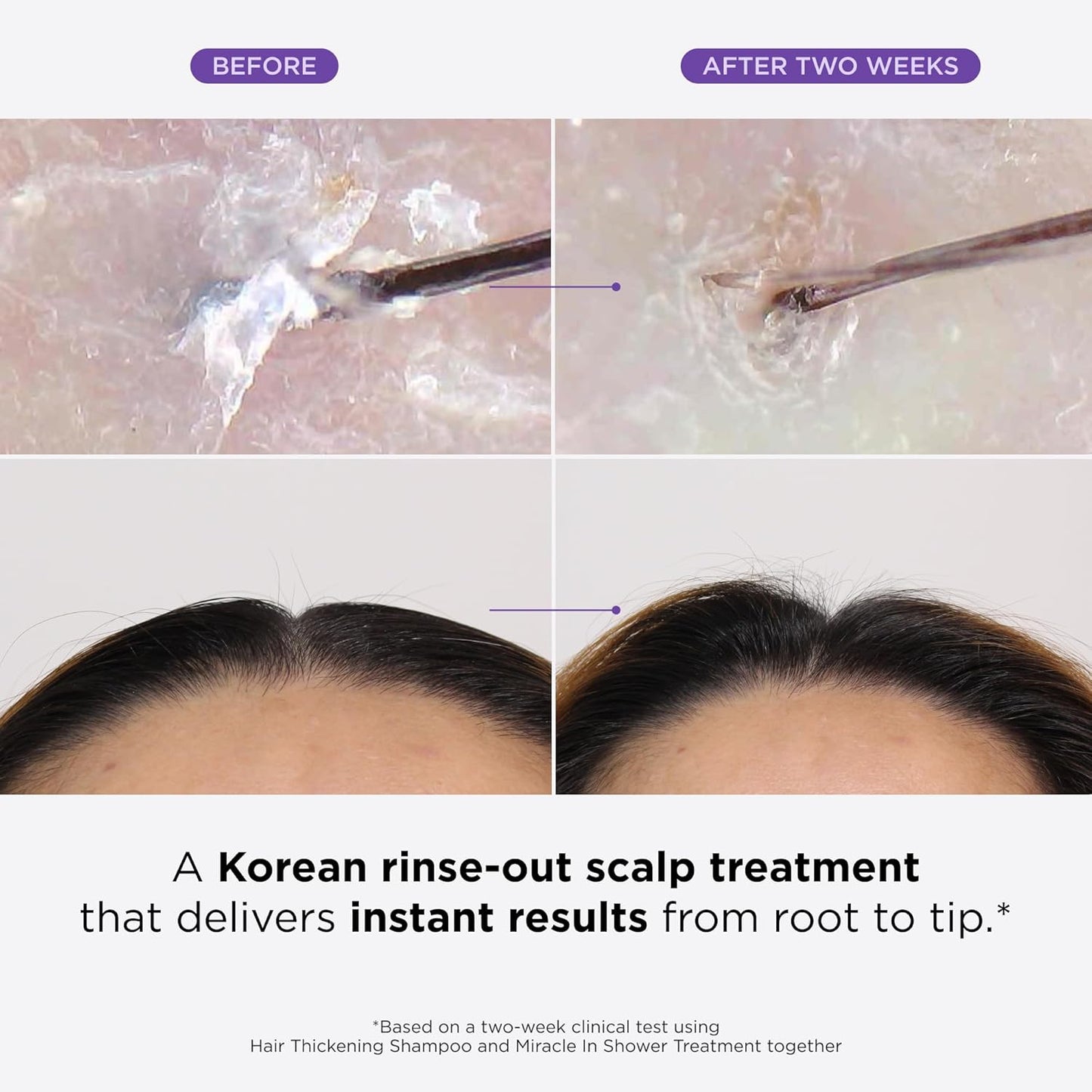 Dr. Groot Thickening Shampoo & Scalp Treatment Set for Hair Loss